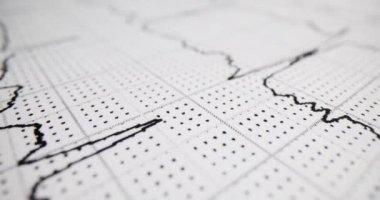 Kağıt üzerinde kalp çizelgesinden gelen elektrik sinyalinin kayıtları. Hastanedeki ekipmanlarla EKG çektiren hasta. Klinikte kalp damar sistemi testleri