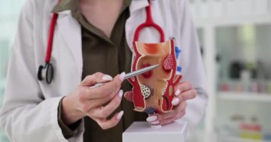 Proktolog, hastanede rektum gerçekçi modelinde sulak hemoroit olduğunu gösteriyor. Doktor hastaya klinikteki hastalık tehlikesi hakkında danışmanlık yapıyor.