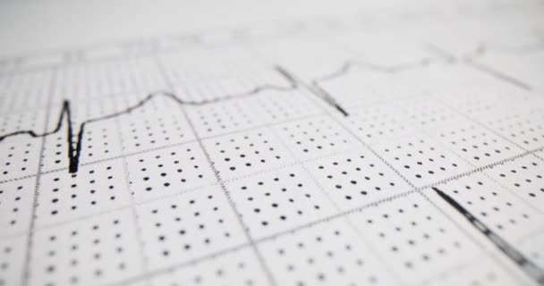 Electrocardiograma Que Muestra Pulso Del Corazón Humano Diagnóstico Miocardiopatía Cardiaca — Vídeos de Stock