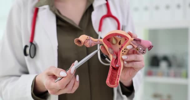 Model Ginekologa Żeńskiego Układu Rozrodczego Trzymającego Długopis Wskazującego Macicę Histeroskopia — Wideo stockowe