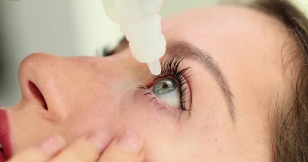 Mujer Pone Gotas Los Ojos Medicamentos Eficaces Para Adultos Problemas — Vídeo de stock