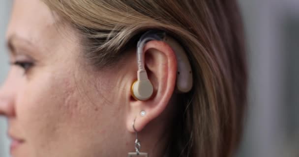 女性は新しい補聴器をテストします 支援補聴器のテストコンセプト — ストック動画