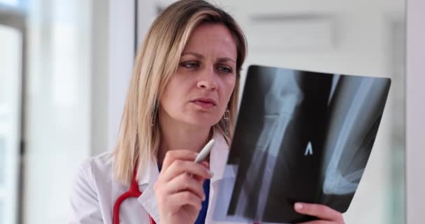 Düşünceli Kadın Doktor Ellerin Röntgen Sonuçlarını Inceliyor Yetişkinler Için Osteopati — Stok video