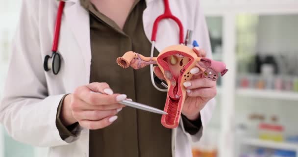 Modèle Système Reproducteur Féminin Entre Les Mains Gynécologue Traitement Inflammation — Video