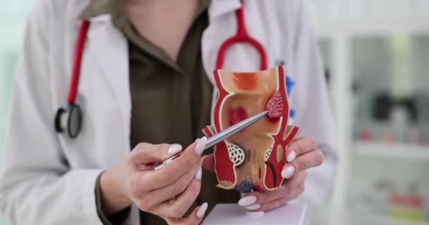 Проктолог Показывает Искусственную Модель Прямой Кишки Человека Диагностика Лечение Геморроя — стоковое видео