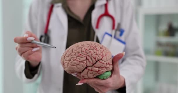 Женщины Невролога Модель Человеческого Мозга Заболевания Головного Мозга Лечение — стоковое видео