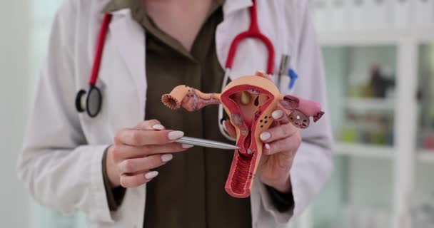 Гінеколог Пояснює Структуру Матки Прототипі Моделі Жінка Направляє Пацієнта Через — стокове відео