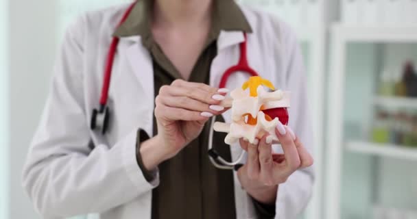 Kadın Fıtık Tedavisi Için Omurga Prototipi Gösteriyor Doktor Fıtıklaşmadan Etkilenen — Stok video