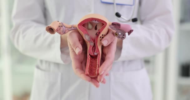 Modell Frisk Livmoder Händerna Gynekolog Livmoderhalssjukdomar — Stockvideo