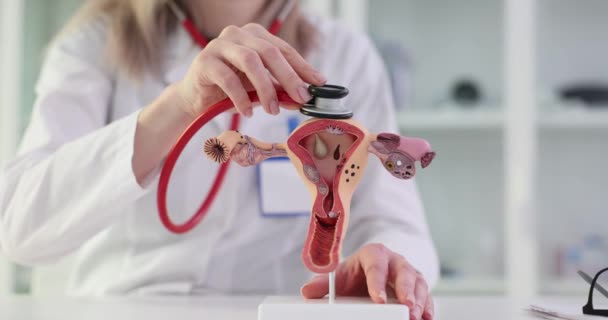 Model Dělohy Stetoskopu Gynekologa Gynekologická Onemocnění Žen Symptomy Diagnostické Metody — Stock video