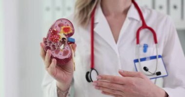 Hastanedeki doktor anatomik bir böbrek örneğiyle duruyor. Klinikte böbrek hastalıklarının tedavisi