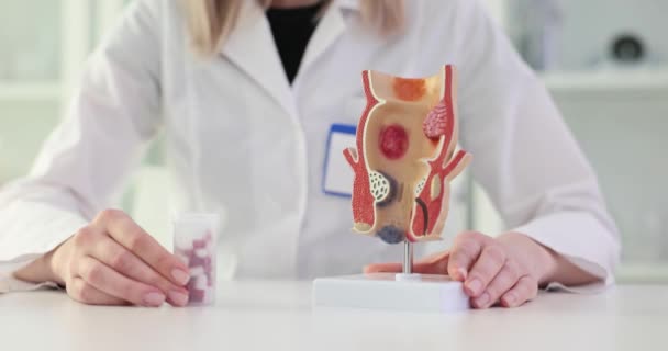 Proctologist Holder Piller Anatomisk Model Endetarmen Begrebet Behandling Hæmorider Rektal – Stock-video