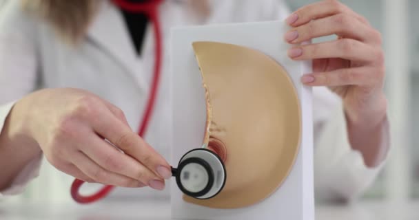 Modelo Anatomía Mamaria Con Estetoscopio Diagnóstico Enfermedad Mama — Vídeos de Stock