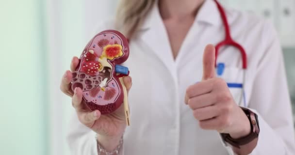 Anatomisches Modell Einer Menschlichen Niere Und Daumen Hoch Vom Urologen — Stockvideo