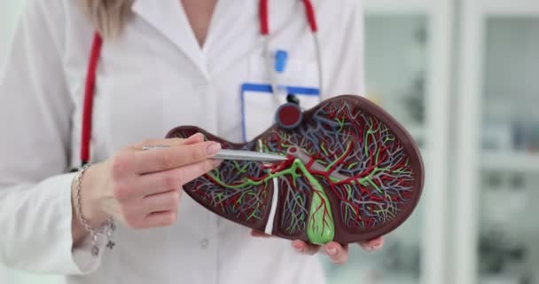 Anatomisch Model Van Leveranatomie Handen Van Een Arts Behandeling Diagnose — Stockvideo