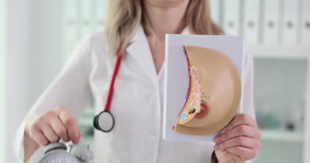 Dokter Memegang Jam Tangan Dan Anatomi Model Payudara Perencanaan Waktu — Stok Video