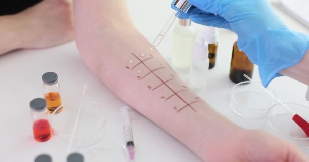 Allergia Teszt Bőr Szúrás Teszt Lehetséges Allergének Bőrallergiavizsgálat — Stock videók