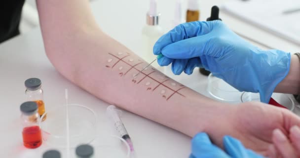 Teste Picada Pele Para Alergias Clínica Métodos Modernos Diagnóstico Alergias — Vídeo de Stock