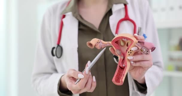 Vrouwelijke Gynaecoloog Demonstreert Een Model Van Het Vrouwelijke Voortplantingsstelsel Gynaecologische — Stockvideo