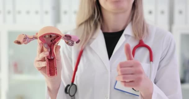 Anatomical Model Healthy Uterus Thumbs Gynecologist Recommendation Treatment Womens Diseases — Stock Video
