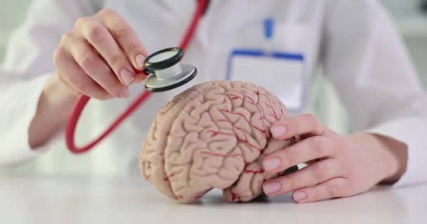 医師は 脳疾患を研究するためにステートスコープを使用しています 血管疾患および治療について — ストック動画