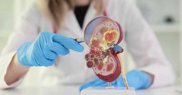 Hitta Sjukdom Abnormitet Eller Patologi Den Konceptuella Njuren Läkaren Håller — Stockvideo