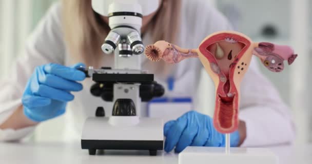 子宮と機能を明らかにする女性の生殖システムの科学的研究 子宮頸部病理の診断と治療 — ストック動画