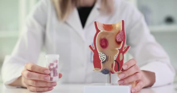 医生模型直肠与发炎的血管结构和药丸 痔疮问题和便秘的治疗 — 图库视频影像
