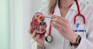Doktor ya da ürolog insan böbreği örneği gösteriyor. Akut piyelonefrit semptomları, neden ve belirtiler.