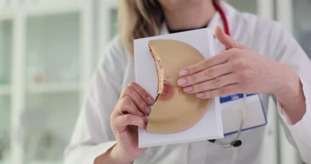 Mulher Diagnosticada Com Câncer Mama Hospital Médico Explica Modelo Anatômico — Vídeo de Stock