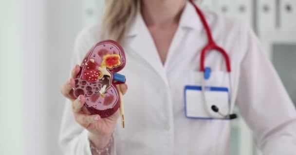 Dokter Heeft Een Anatomisch Model Van Een Nier Een Horloge — Stockvideo