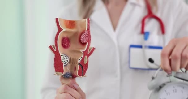 医生拿着人体结肠和手表的三维模型 结肠癌的早期发现和治疗及时间的重要性标志 — 图库视频影像