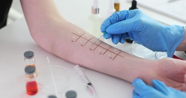 Test Skórny Alergię Rękę Pacjenta Klinice Alergiczne Testy Skórne Zdrowie — Wideo stockowe