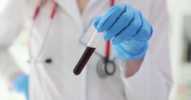 Doktor tüpteki kan örneğine bakar. Kan testi ve hasta sağlığı