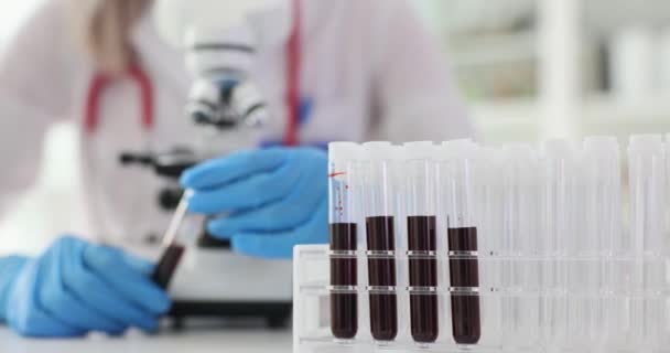 Аналіз Зразків Крові Медична Діагностика Захворювання Лікар Вивчає Зразки Крові — стокове відео