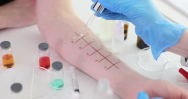 Doktor alerji kontrolü için insan koluna pipetli sıvılar yerleştiriyor. Laboratuvar çalışanı deney sırasında tahriş belirtilerini gözlemler.