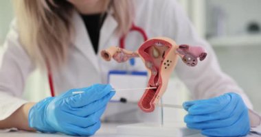 Rahim ve rahim boynu modeli analiz ediliyor. Sitogram ve servikal kazıntıların sitolojik incelemesi