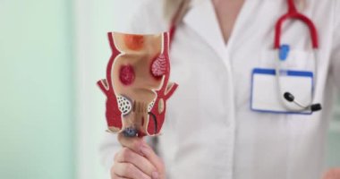 Doktor insan bağırsağının modelini tutuyor ve izliyor. Kolon kanserinin erken teşhis ve tedavisinin önemi kavramı.