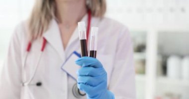 Klinikte iki test tüpü ve hasta kan örneği tutan bir doktor var. Kan sayımı, lökosit sayımı ve ESR.