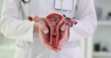 Hastanede teşhis ve tedavi için anatomik modeli olan jinekolog doktor. Hastalık belirtilerinin endometriti