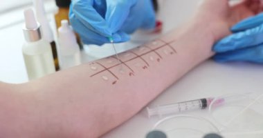 Deri testleri ve klinikteki hasta cildinde penis testi. Doktor hasta cildine alerji testi yapıyor.