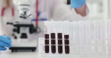 Bilim adamı kan örneklerini test tüplerine aktarıyor. Kan hastalıkları semptomlara neden olur
