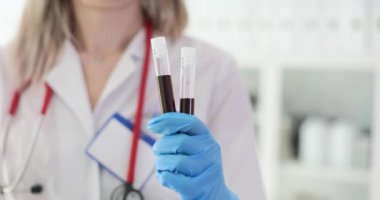 Doktor kan örnekleriyle birlikte iki test tüpü tutuyor. Hematoloji semptomları ve tedavisi