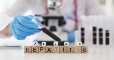 Hepatit A B C D E ve iltihaplı karaciğer hastalıkları. Hepatit nedenleri, semptomlar ve tedavi seçenekleri
