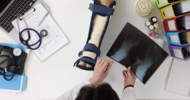 Doktor, klinikte bacağı kırık bir hastayı muayene ediyor. Bacak kırığı semptomlara, teşhislere ve tedaviye neden olur.