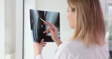 Kadın doktor kırıklar için röntgen görüntüsünü inceliyor. Kadın doktor, sapmaları yavaş çekimde tespit etmek için kemik yapısını inceliyor.