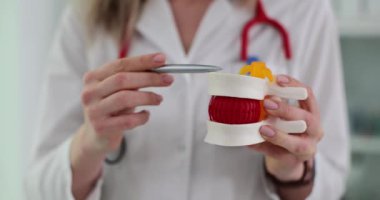 Kadın, bel diski modelini kullanarak sağlık sorununu açıklıyor. Doktor bel omurgasının ve ilgili disk patolojisinin anatomik özelliklerini gösteriyor.