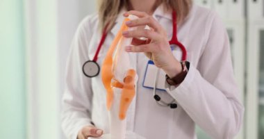 Travmatolog hasta ziyareti sırasında diz eklemi modeli gösteriyor. Doktor, diz ekleminin anatomisini ve travmadan etkilenen belirli bölgeleri gösteriyor.