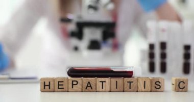 Tıp laboratuarında Hepatit C küp ve kan örneği yaz. Hastanede karaciğer virüsü tedavisinde iltihap. Sağlık hizmetleri