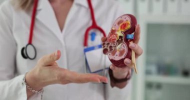 Kadın doktor, böbrek modelinin görünür hasarlı olduğunu gösteriyor. Profesyonel doktor böbrek hastalıklarının neden ve sonuçlarını açıklıyor